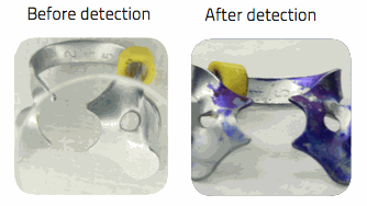 detection of dental instruments