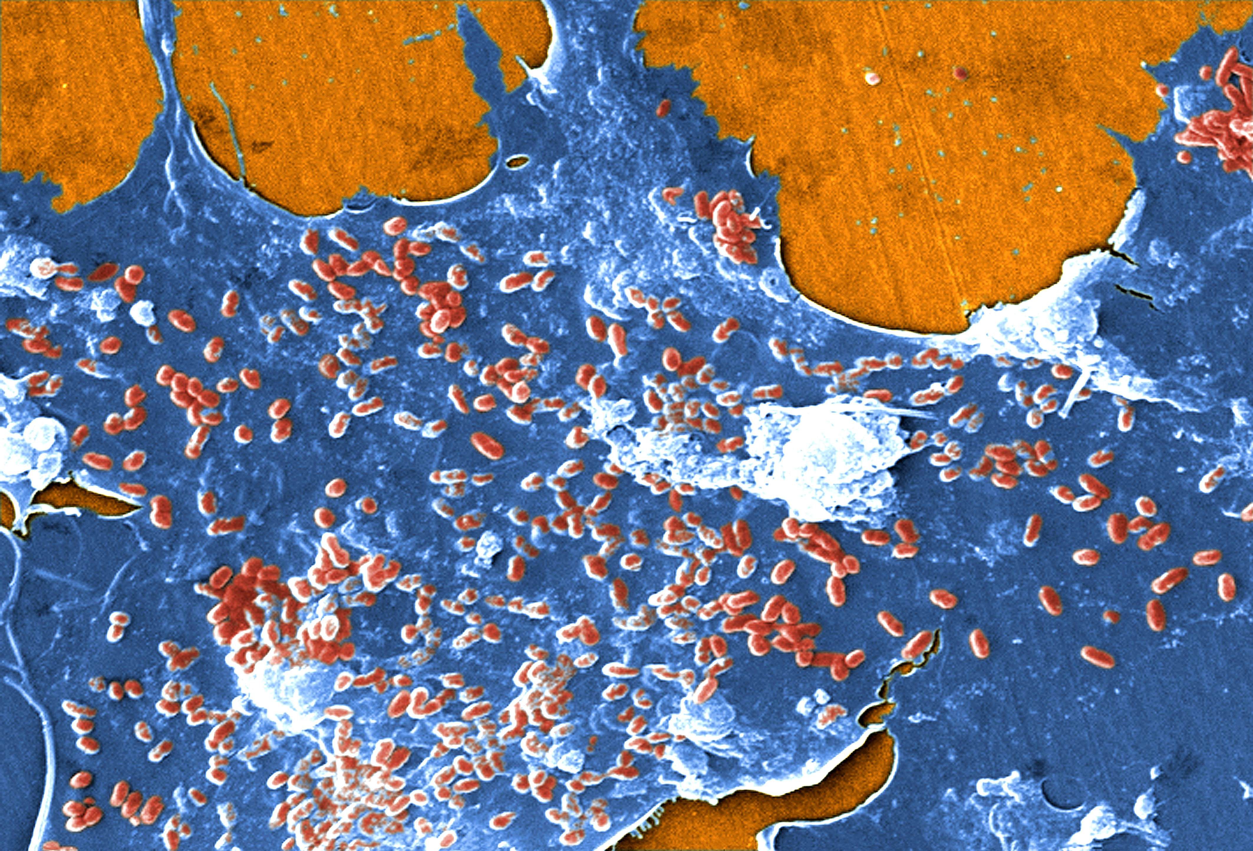 Bioburden & Biofilms