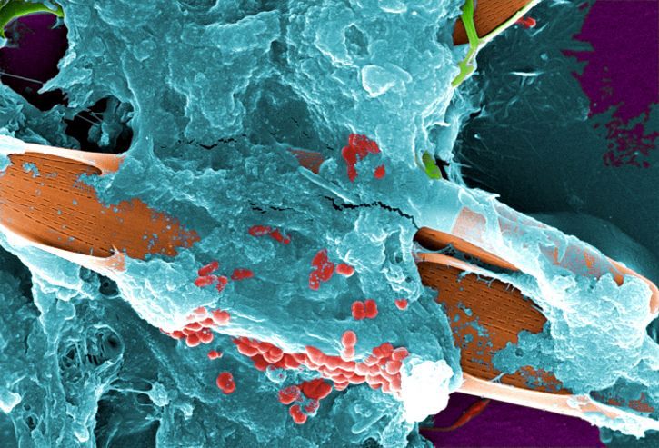 Bioburden on surgical instruments